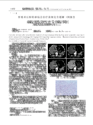 肝癌术后肺转移综合治疗获得完全缓解1例报告