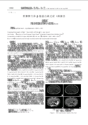 肝脾肿大伴β脂蛋白缺乏症1例报告.pdf