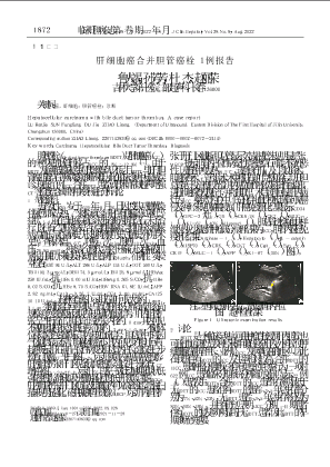 肝细胞癌合并胆管癌栓1例报告.pdf